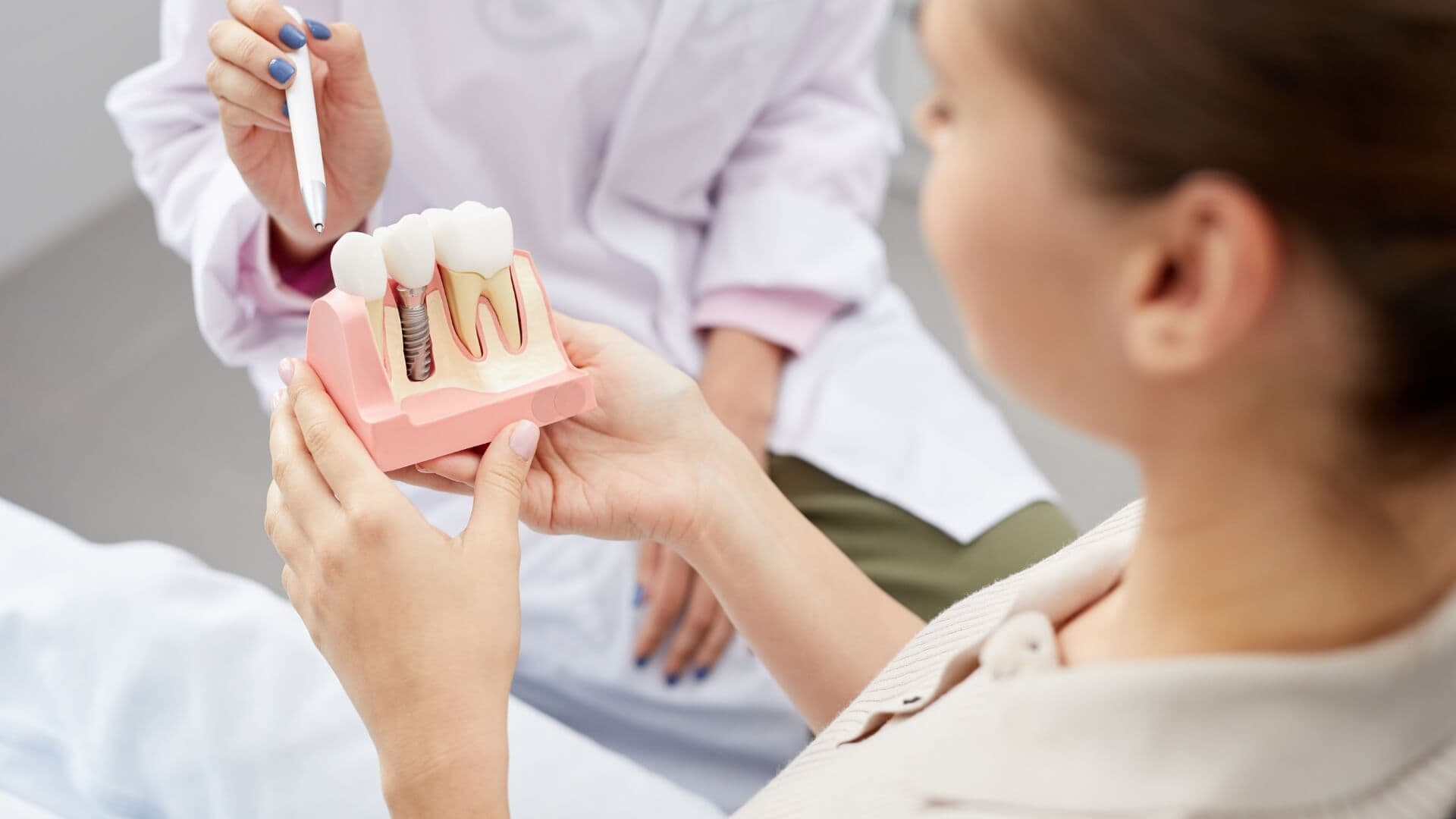 Implanty dentystyczne vs. protezy: Co jest lepsze w 2025 roku?