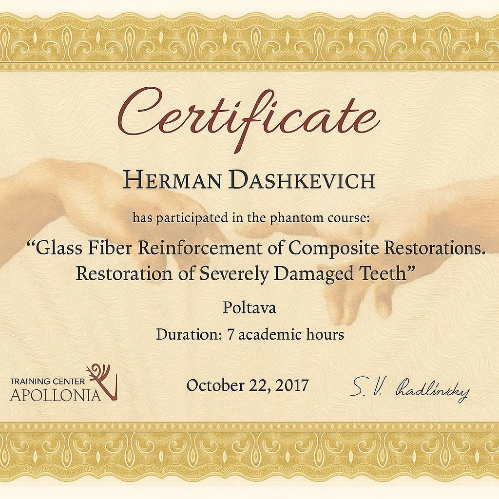 Adhesive Bridges – Direct Method (Apollonia, 2017) Adhesive bridge constructions. Direct method