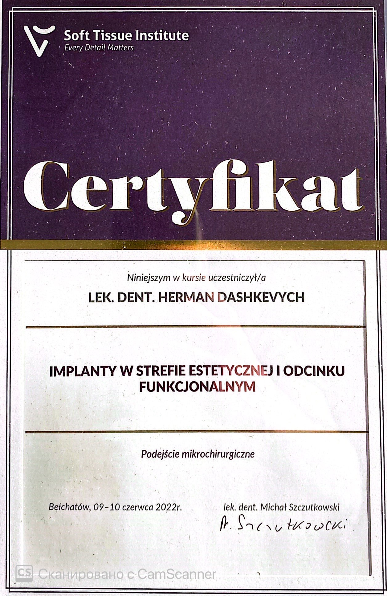 Soft Tissue Surgery – Gingival Recessions (Szczutkowski) Plastic surgery of soft tissues - covering of gingival recessions
