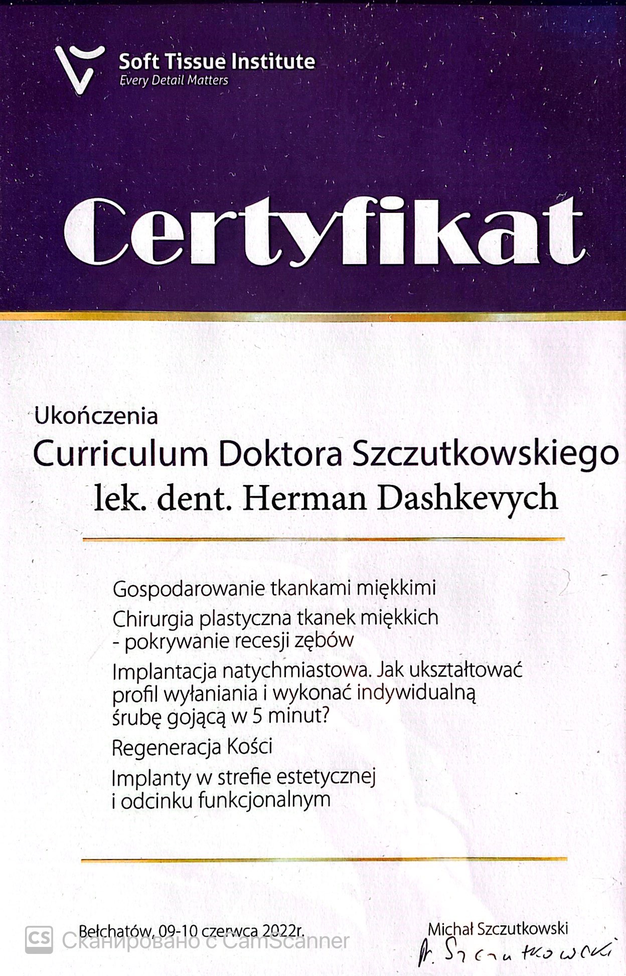 Maxillary Sinus Lift – Clinical Practice (Ciapinski) Maxillary sinus floor elevation in clinical practice