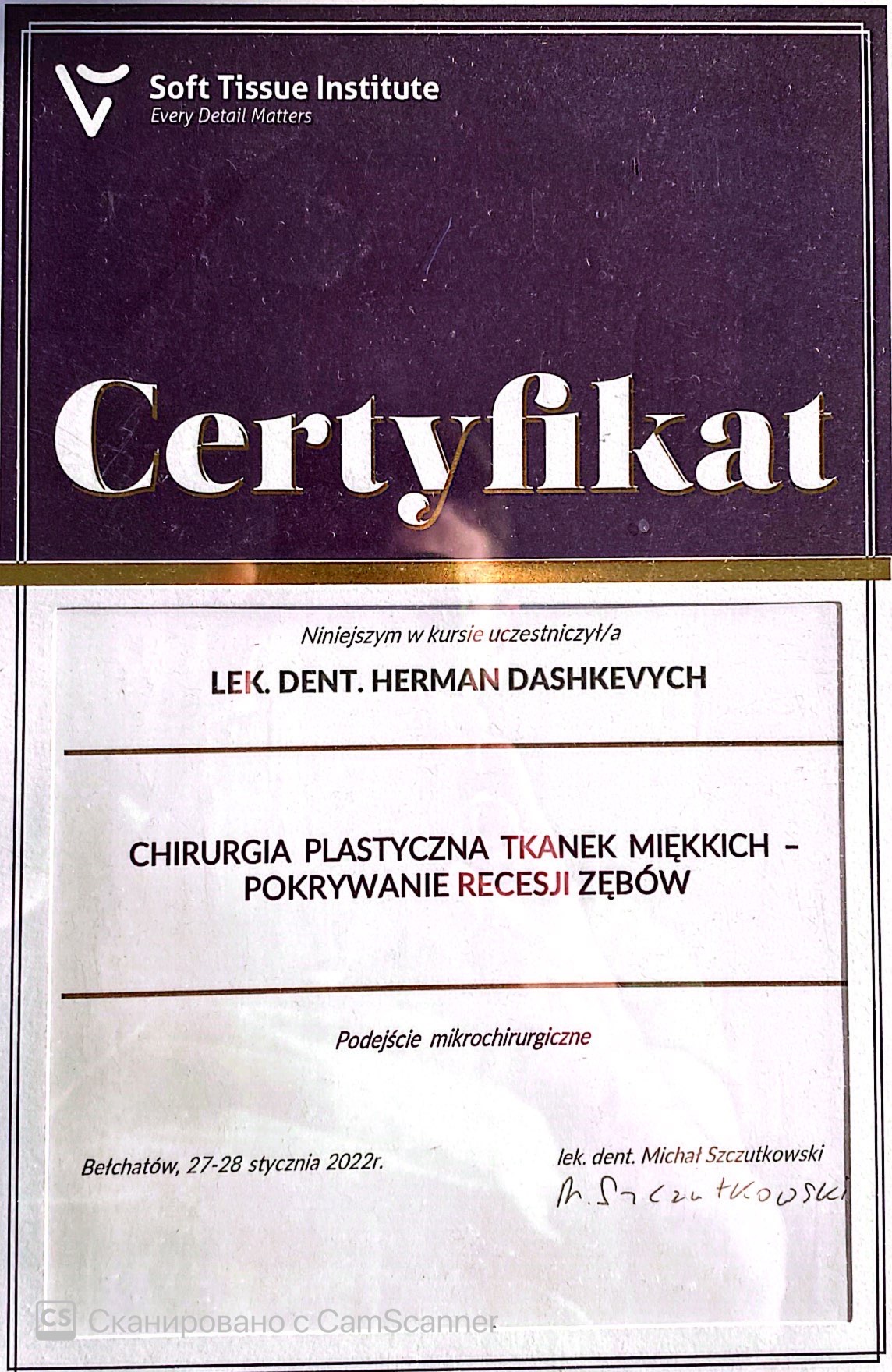 Composite Restorations – Glass Fiber (Apollonia, 2017) Glass fiber reinforcement of composite restorations